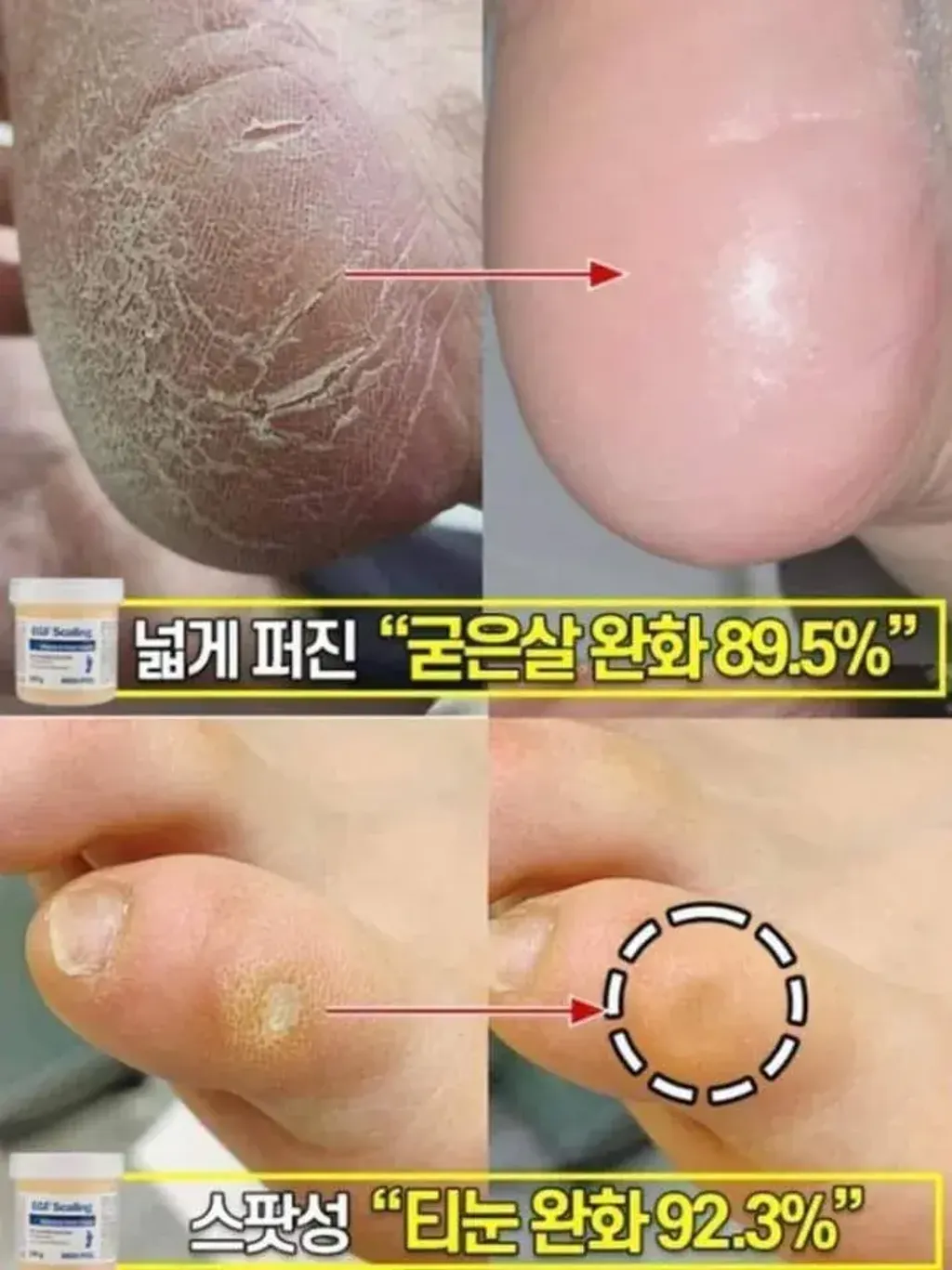 80062742