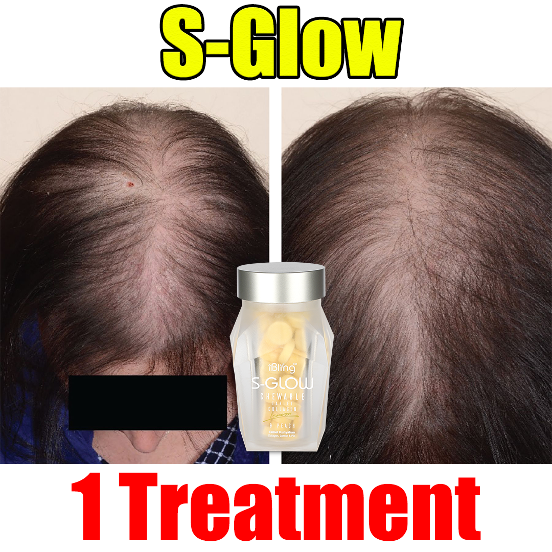 sglow 1