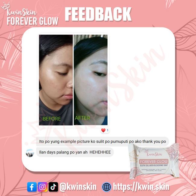 Kwin Skin | Customer Feedbacks - 