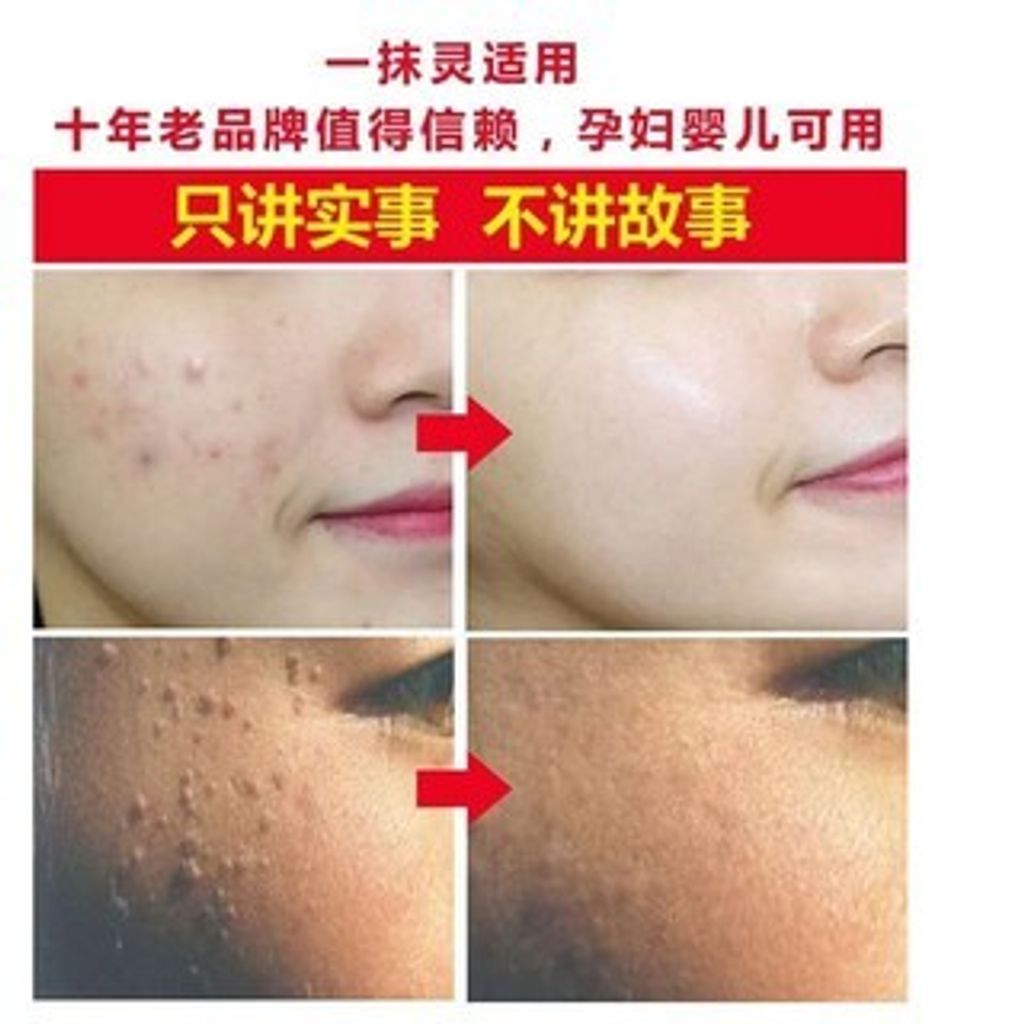 2ae7bf785c59d007e017c827062ff893_tn