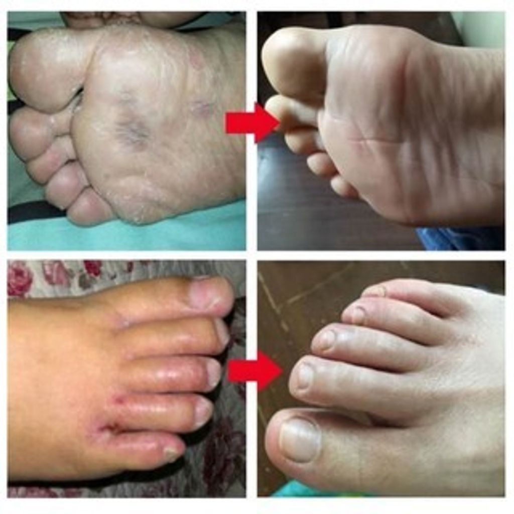 6d624a4cb2b3350ce2d5f285cbbb5b37_tn