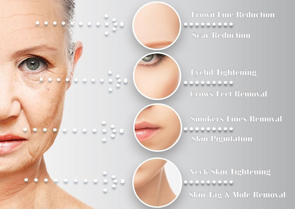 IMG_3701-1740307537475