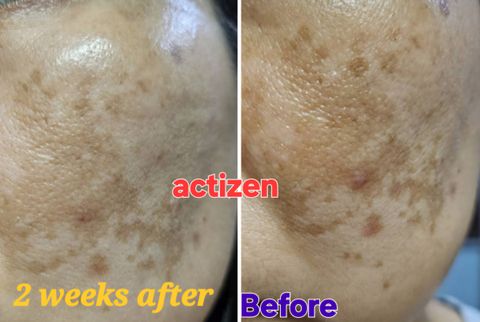 before & after 5.01.25