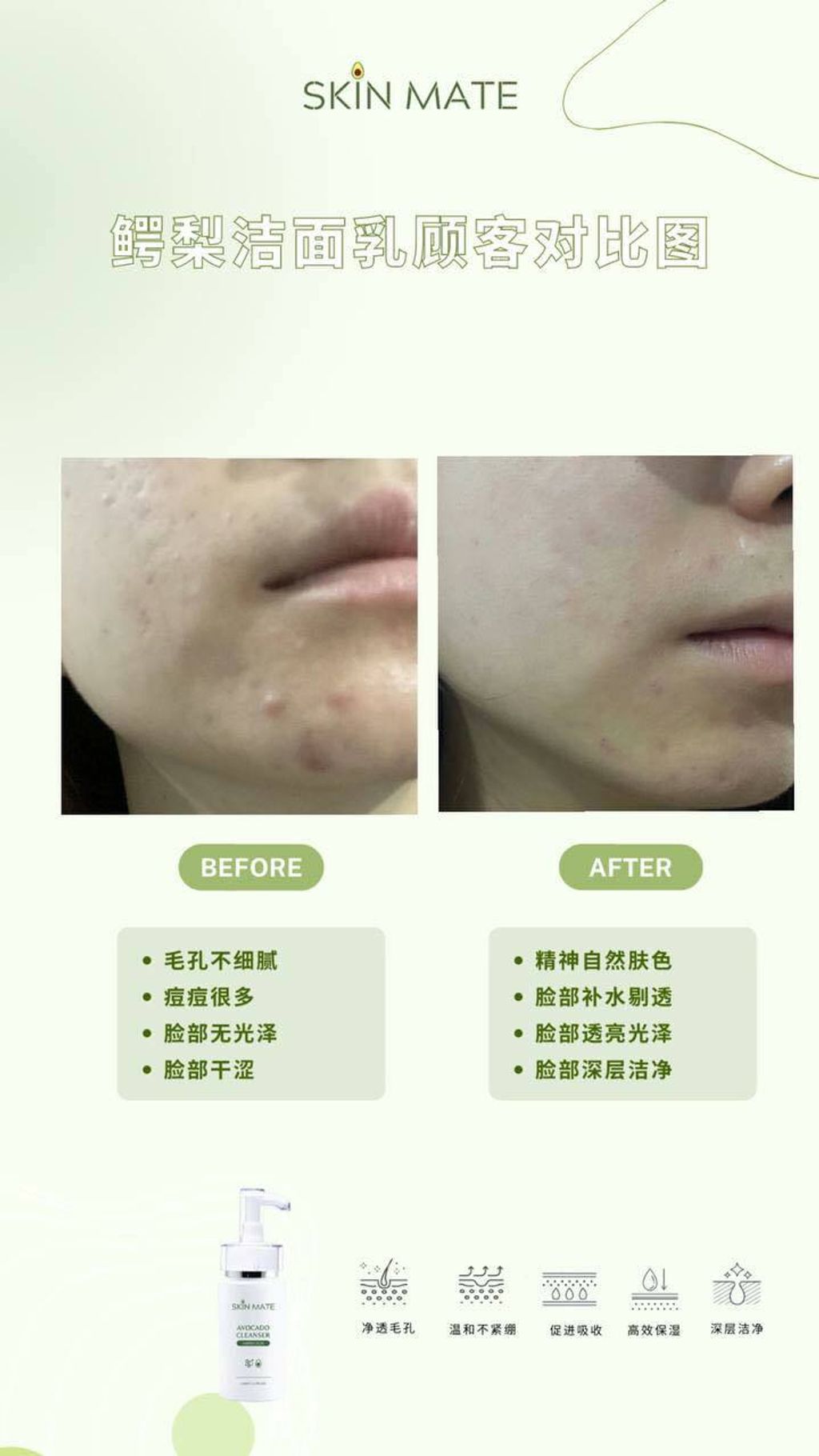 SKINMATE CLEANSER 7