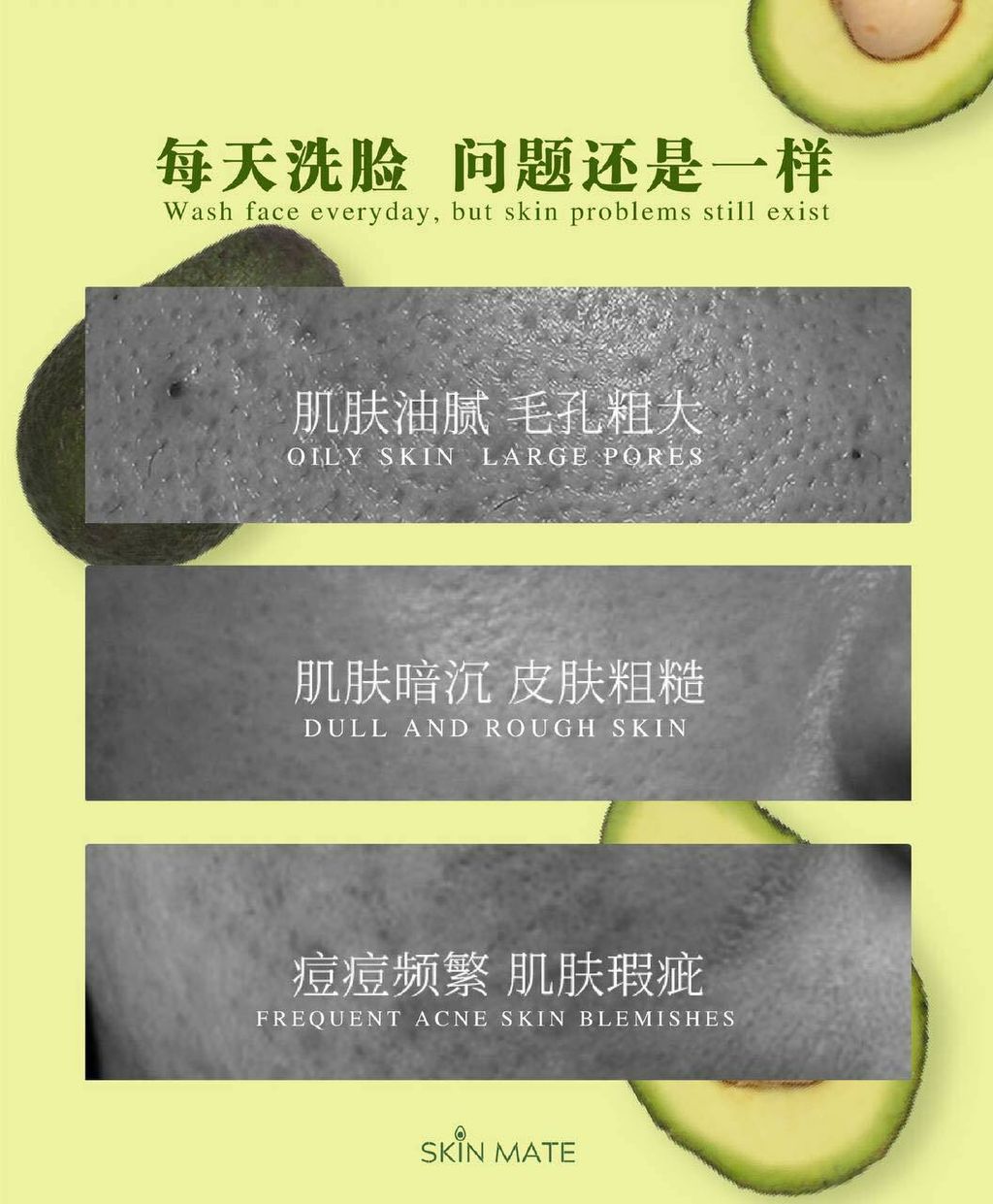 SKINMATE CLEANSER 6