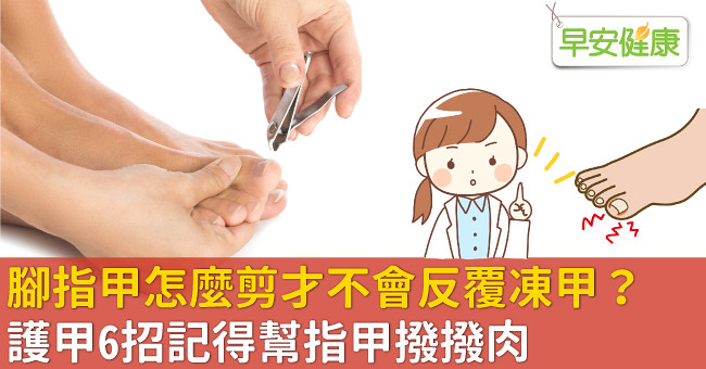 腳指甲怎麼剪才不會反覆凍甲?護甲6招記得幫指甲撥撥肉 腳指甲怎麼剪才不會反覆凍甲?護甲6招記得幫指甲撥撥肉