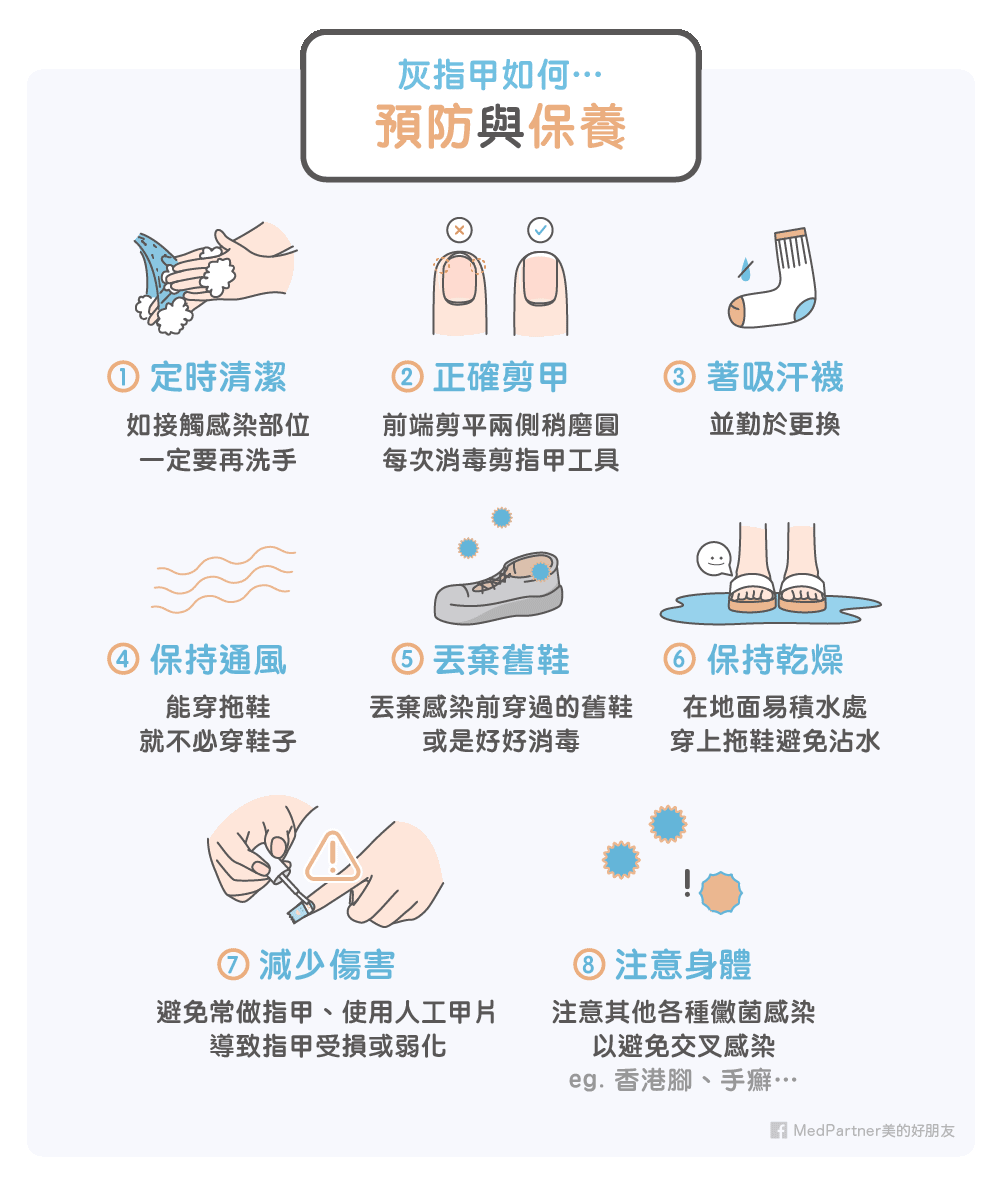 灰指甲如何預防及保養