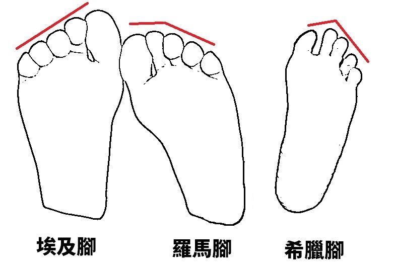腳型類別1